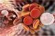 Maladie des vaisseaux : aux origines de la thrombose veineuse