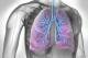 Tuberculose : identifier des moyens pour contourner la résistance bactérienne