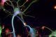 Maladie de Parkinson : de nouveaux modèles cellulaires pour étudier la mort neuronale